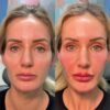 The Future of Facial Rebalancing at Eternia Medspa