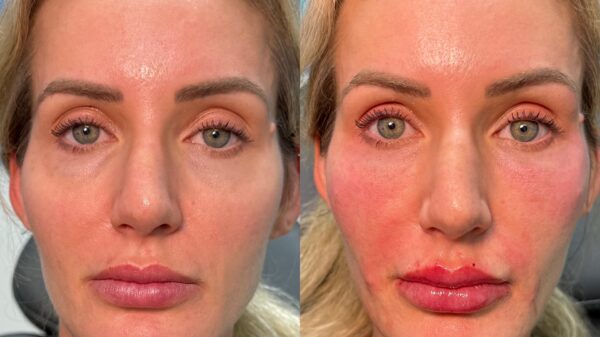 The Future of Facial Rebalancing at Eternia Medspa
